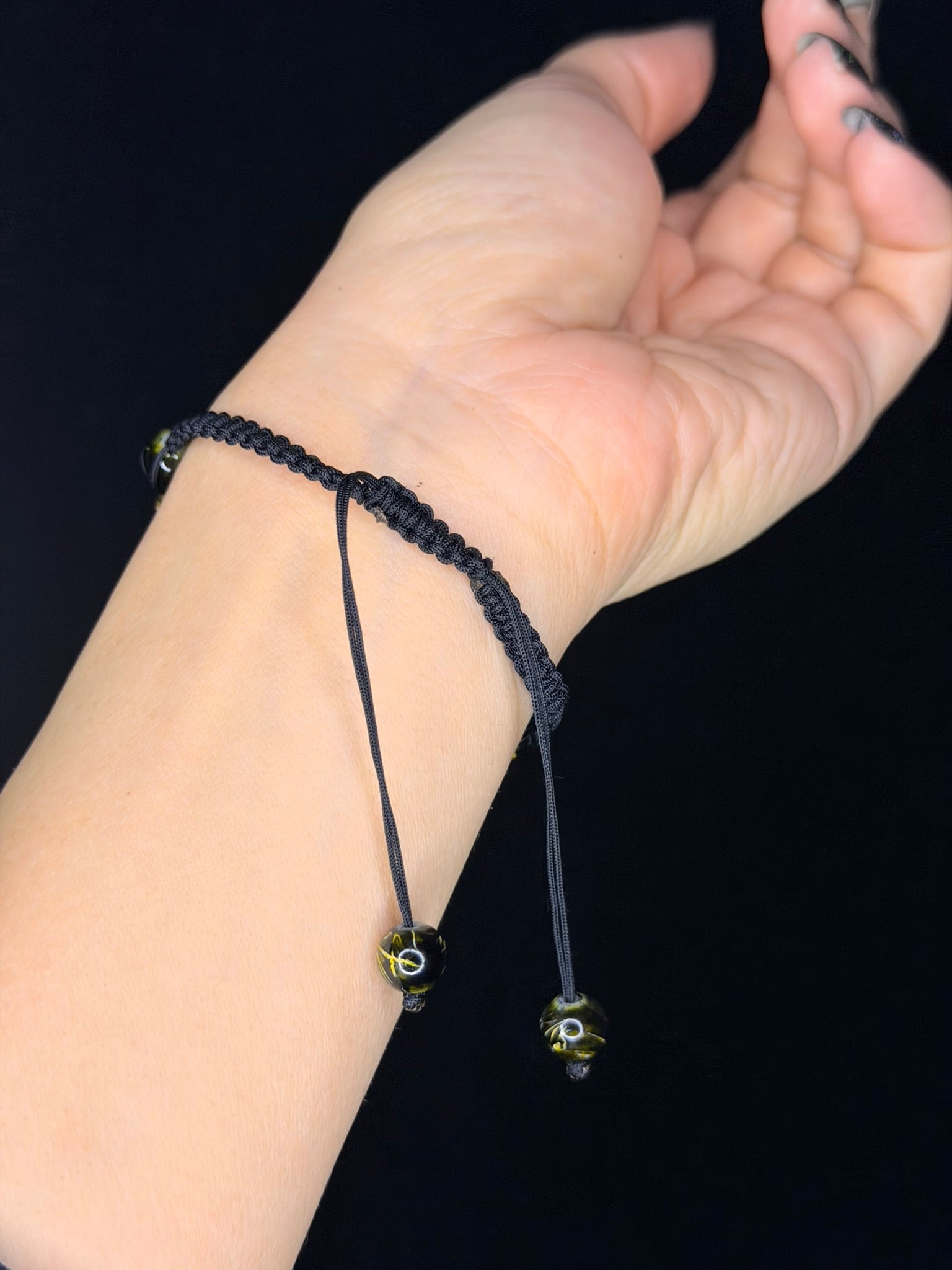 BIA0170